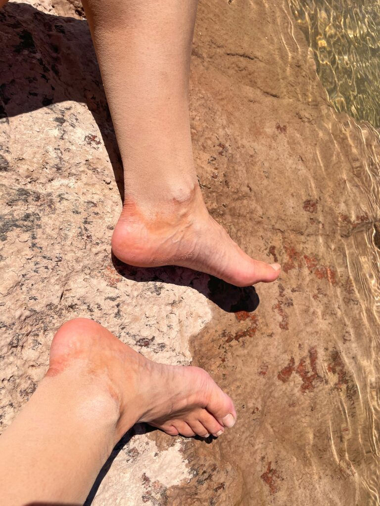 dusty swollen legs from hiking